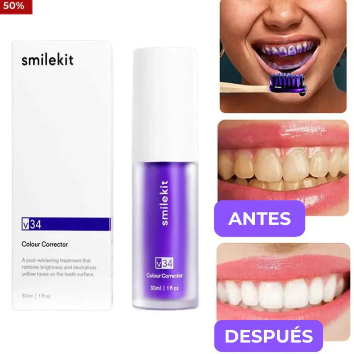 Blanqueador DENTAL SMILEKIT + restaurador